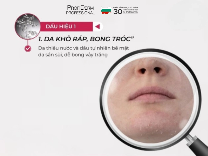 Tác hại của stress đối với làn da Tác hại của stress đối với làn da