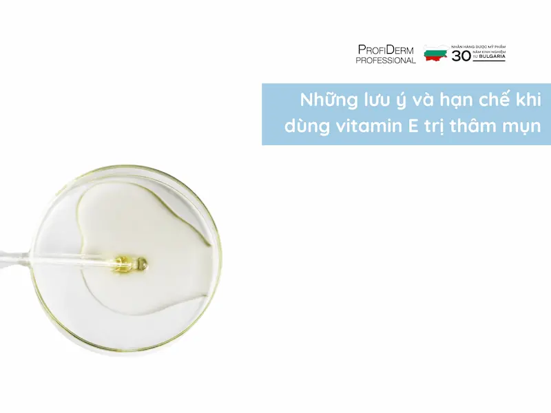 Những lưu ý và hạn chế khi dùng vitamin E trị thâm mụn Những lưu ý và hạn chế khi dùng vitamin E trị thâm mụn