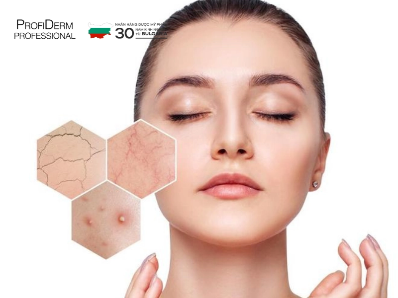 kem dưỡng ẩm cho da nhạy cảm kem dưỡng ẩm cho da nhạy cảm