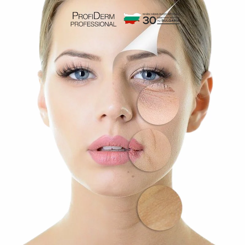 phục hồi da yếu đỏ phục hồi da yếu đỏ