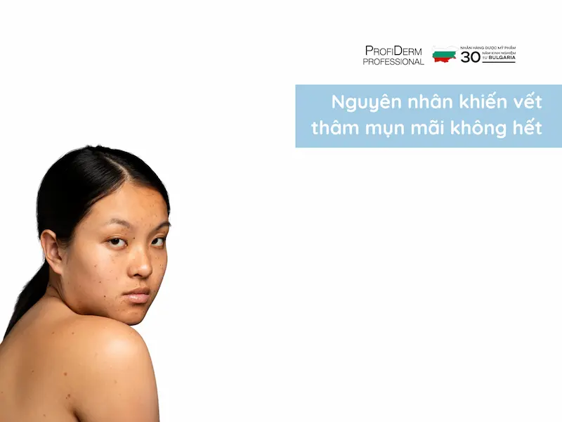 vết thâm mụn mãi không hết vết thâm mụn mãi không hết