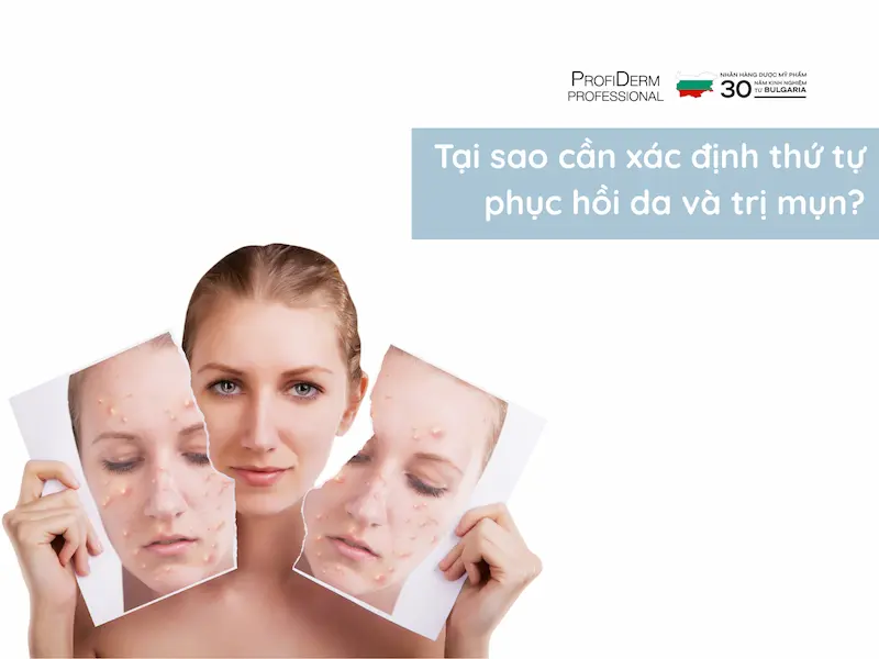 nên phục hồi da trước hay trị mụn trước nên phục hồi da trước hay trị mụn trước