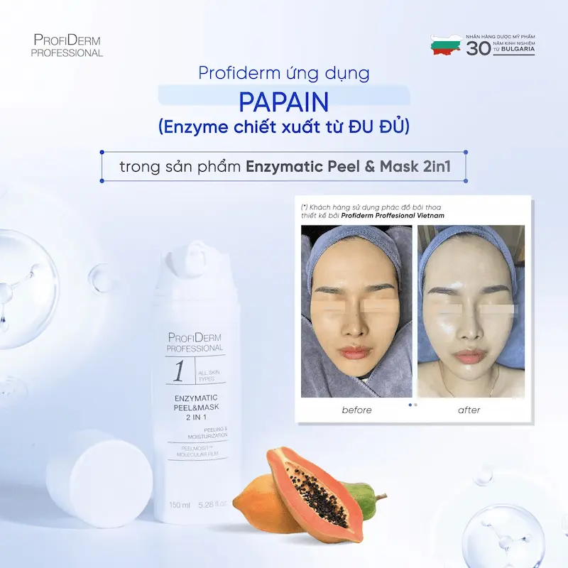 Phục hồi da nhiễm corticoid nặng Phục hồi da nhiễm corticoid nặng