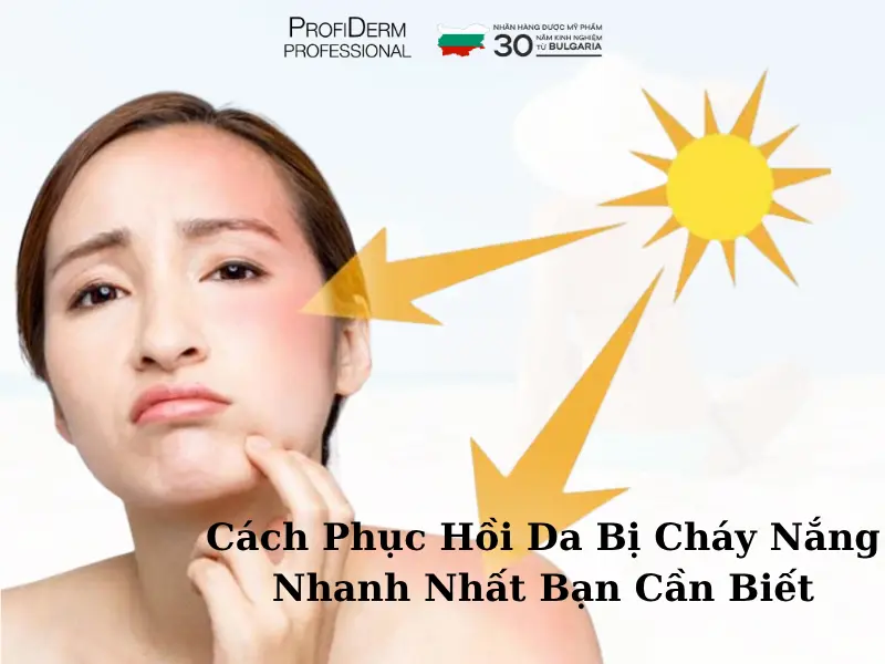 cách phục hồi da bị cháy nắng nhanh nhất cách phục hồi da bị cháy nắng nhanh nhất