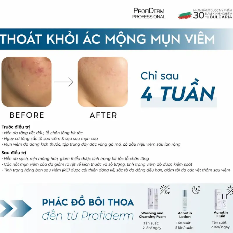 Gợi ý sản phẩm phục hồi da từ Profiderm Gợi ý sản phẩm phục hồi da từ Profiderm