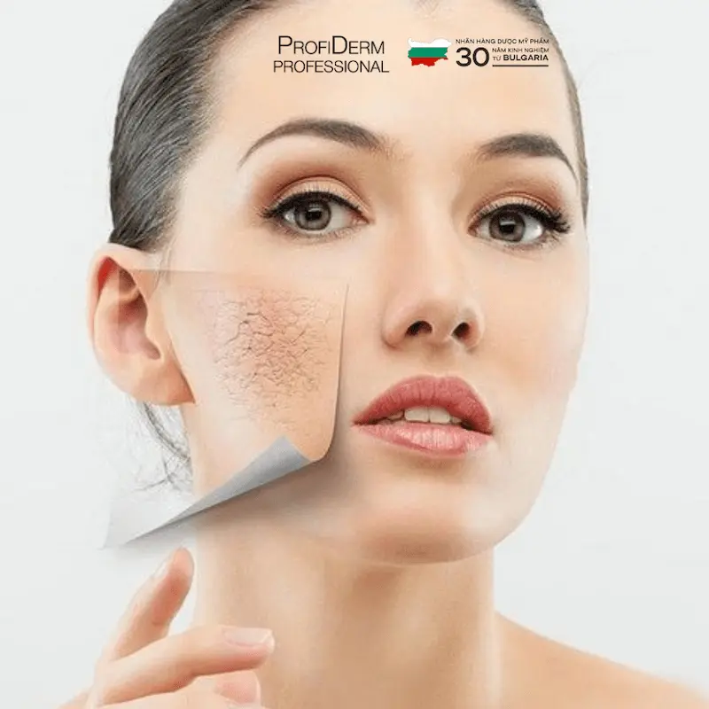 phục hồi da sau peel phục hồi da sau peel