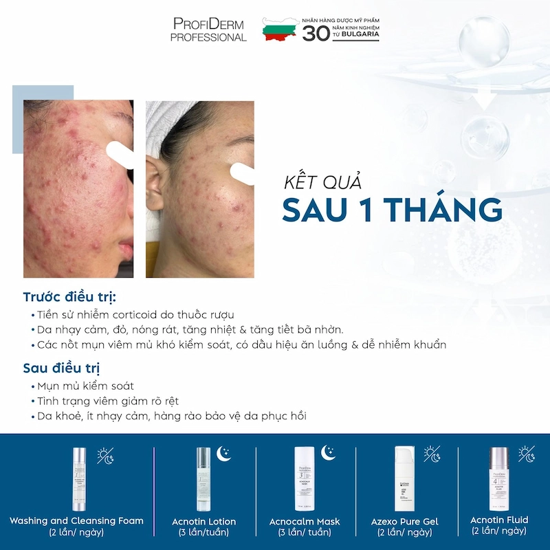 Công dụng vượt trội của Azexo Pure Gel cho làn da Công dụng vượt trội của Azexo Pure Gel cho làn da