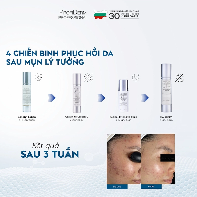 Profiderm Việt Nam – Giải pháp chuyên biệt cho da khô nhạy cảm Profiderm Việt Nam – Giải pháp chuyên biệt cho da khô nhạy cảm
