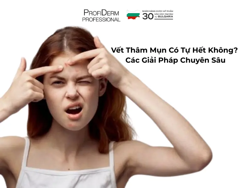 vết thâm mụn có tự hết không vết thâm mụn có tự hết không