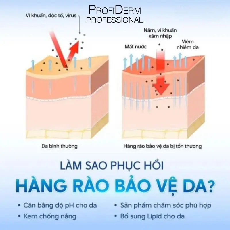 da mỏng lộ mao mạch da mỏng lộ mao mạch