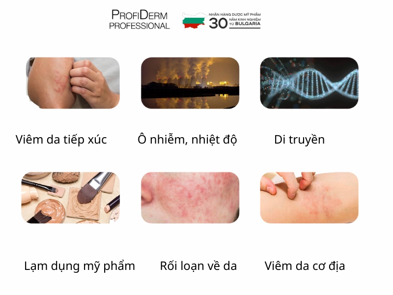 Các yếu tố gây ra hoặc làm trầm trọng thêm tình trạng da nhạy cảm Các yếu tố gây ra hoặc làm trầm trọng thêm tình trạng da nhạy cảm