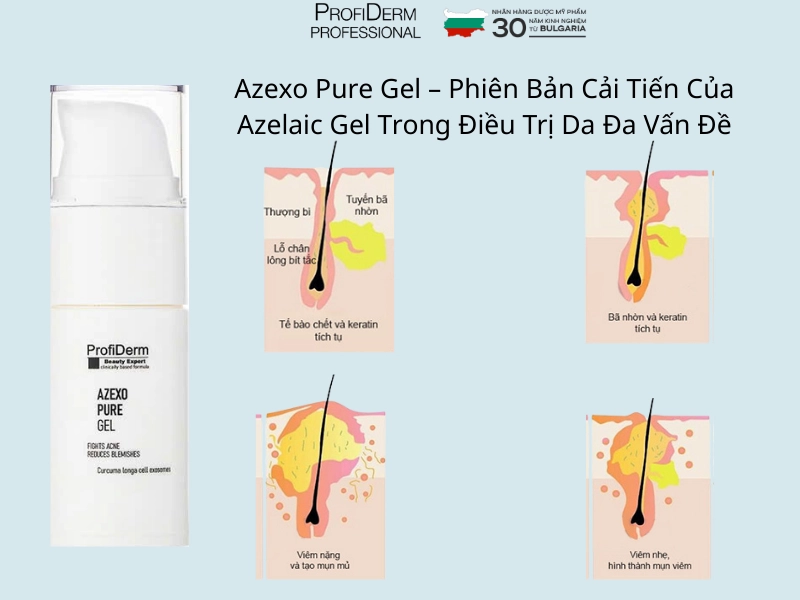 Azexo pure gel Azexo pure gel
