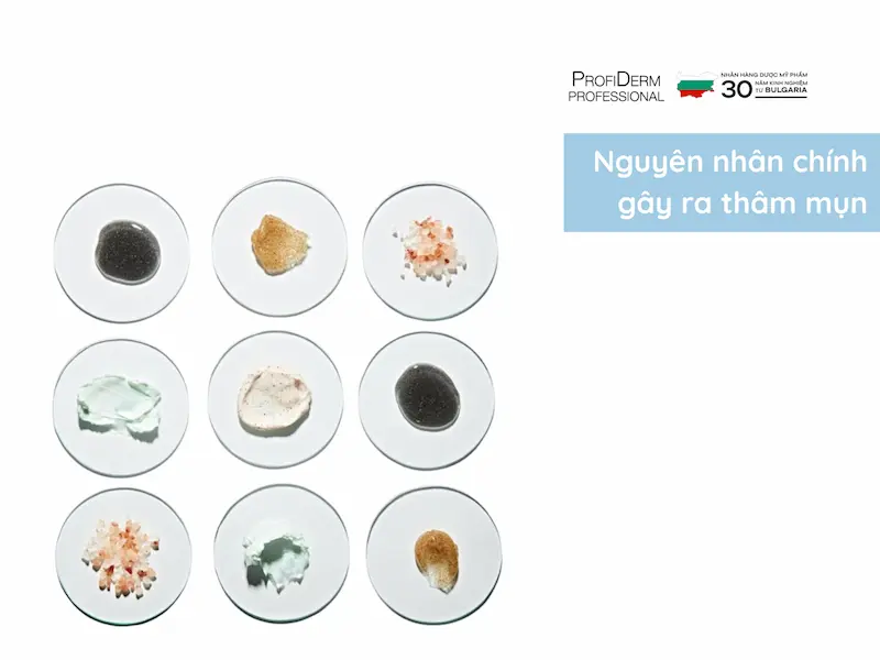 thâm mụn thâm mụn